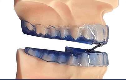 Como funciona o tratamento intraoral e quais os benefícios